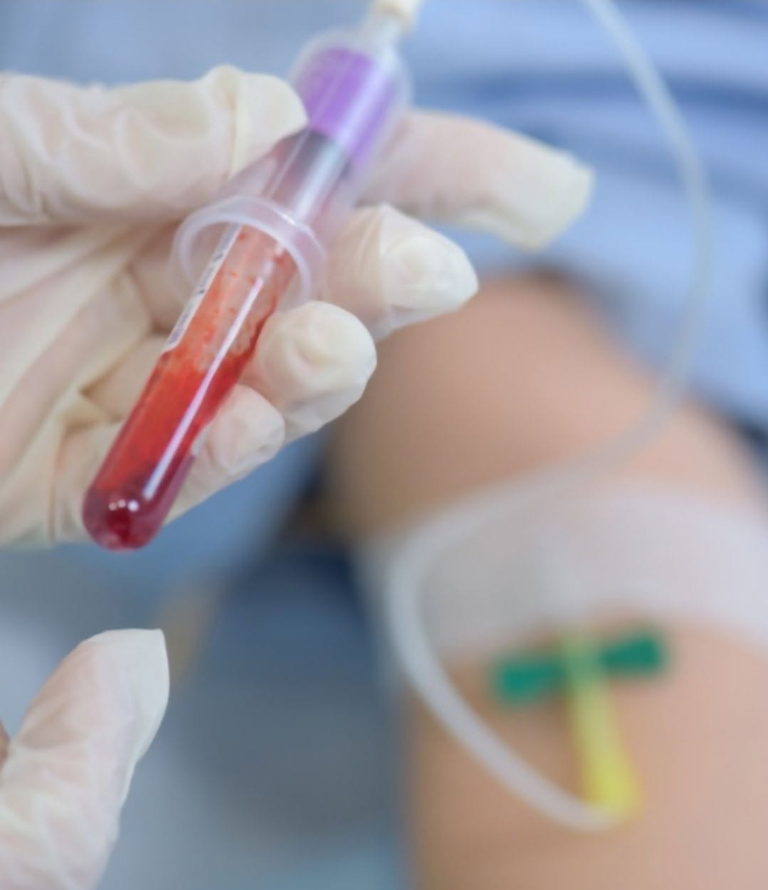 Ticket maggiorati anche sul sangue. Cittadini svenati!
